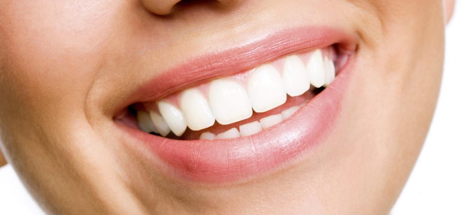 white-teeth